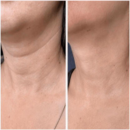 PDRN Collagen Gua Sha Neck Wrinkle Cream 90g